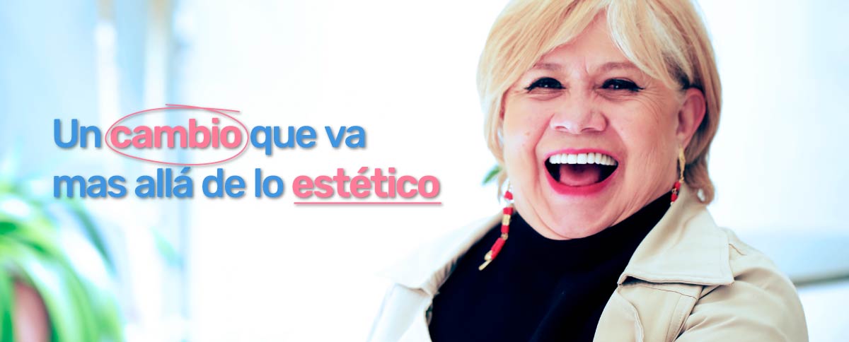 Conoce el caso de Yamile y sus implantes dentales